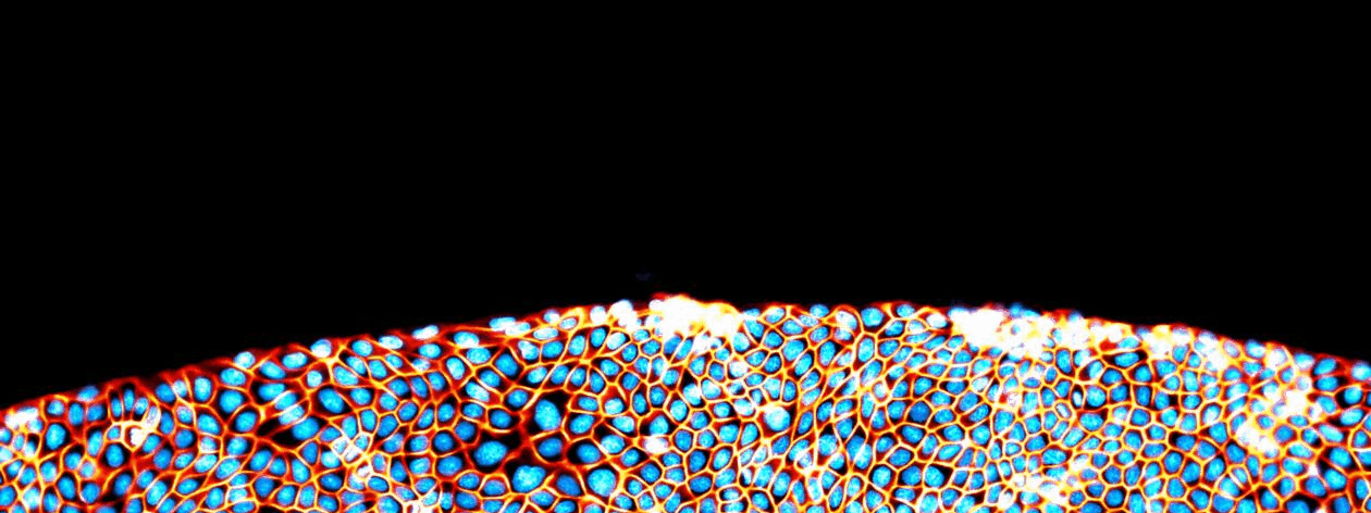 tissue
